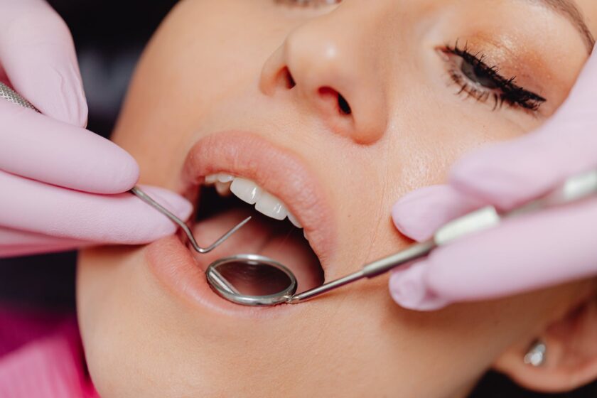 close up photo of a woman getting a dental check up